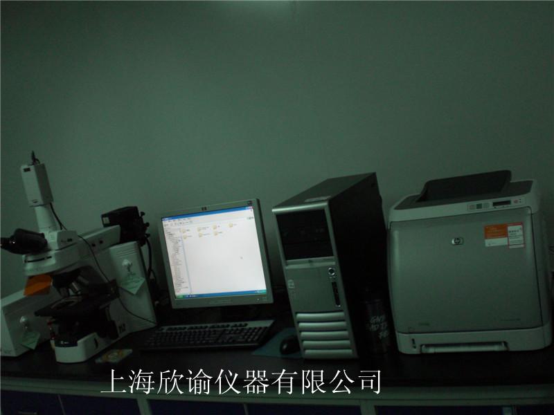 染色體分析系統XY-RS-A,欣諭染色體圖像分析系統，核型圖像分析系統